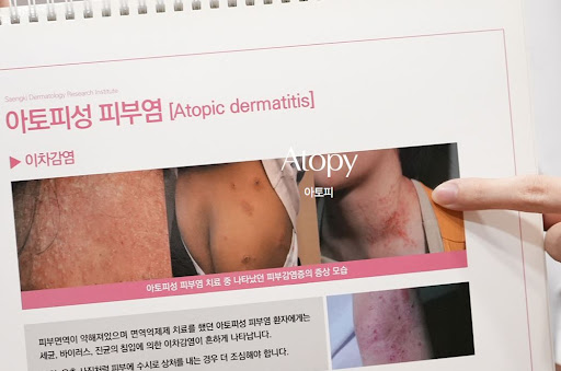 생기한의원 아토피 상담에서 증상 범위를 기록하면 좋은 이유